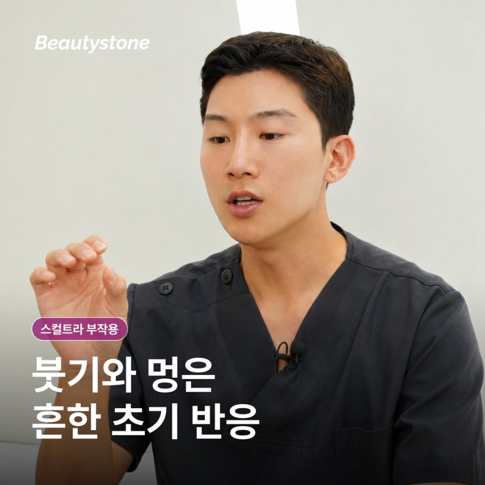 What to Know Before Sculptra Treatment: Side Effects, Pain, and Swelling image 2
