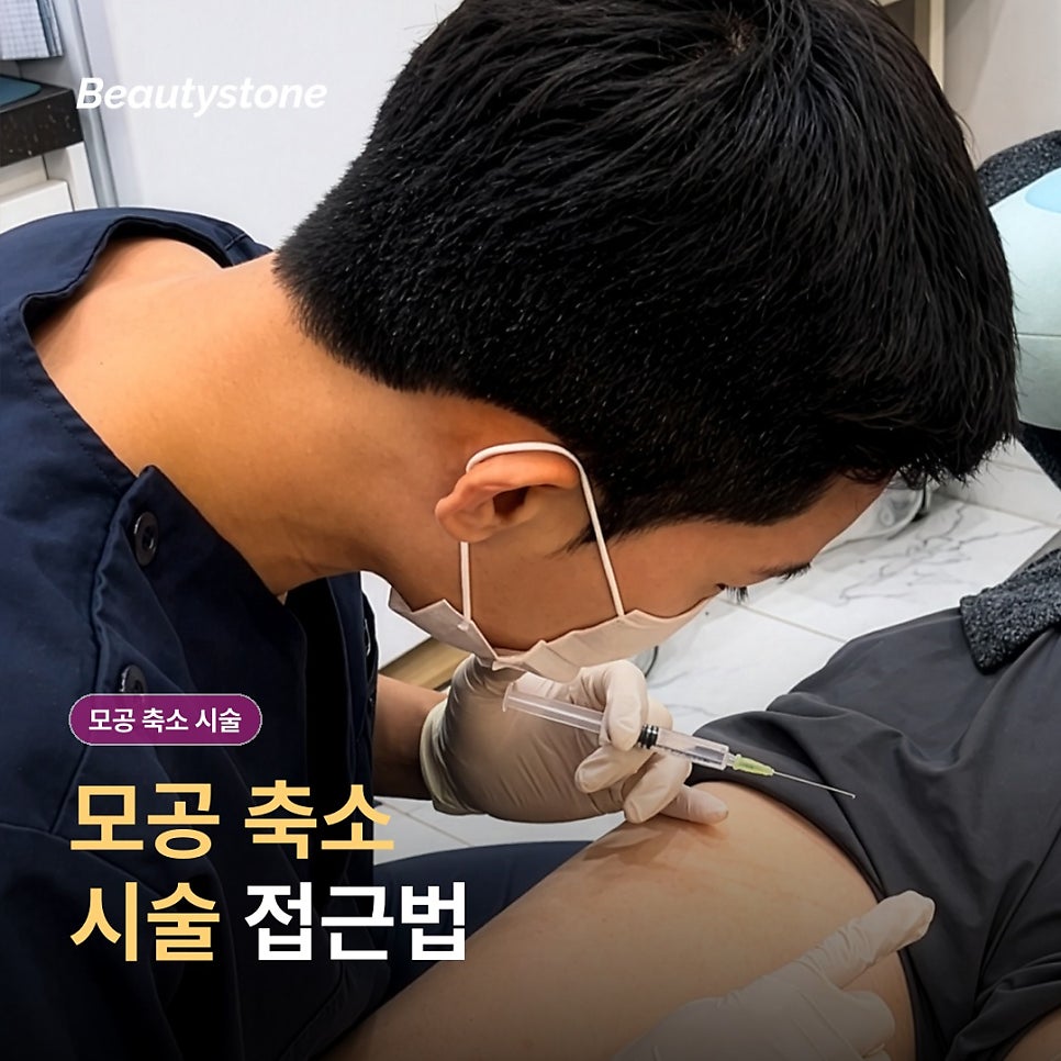 모공 축소 시술, 넓어 보이는 원인부터 알아볼까요? 관련 이미지 3