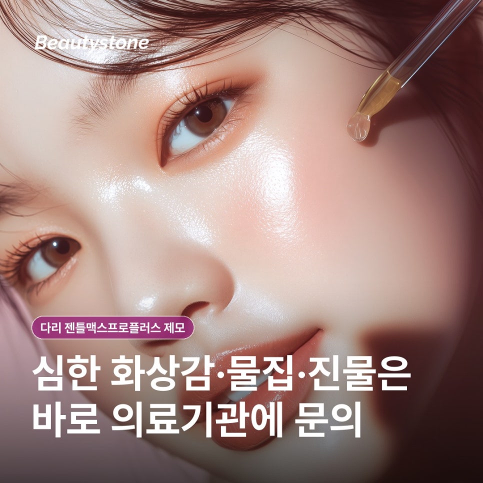 다리 젠틀맥스프로플러스 제모, 원리와 회차·통증·관리까지 관련 이미지 8