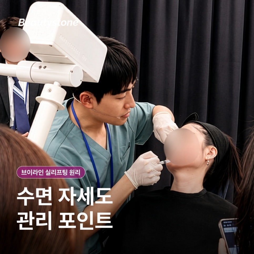 How V-Line Thread Lifting Works: What to Know Before the Procedure image 10