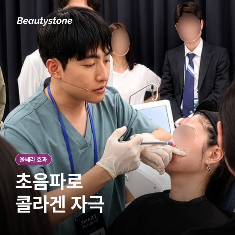 울쎄라 효과, 언제 어떻게 나타날까 관련 이미지 2