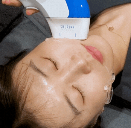 슈링크 효과 시기, 300샷과 같이 알아보기 관련 이미지 2