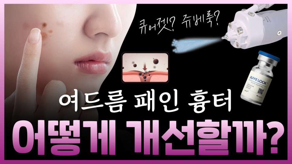 합정역 피부과, 큐어젯 쥬베룩으로 여드름 흉터개선 관련 이미지 2