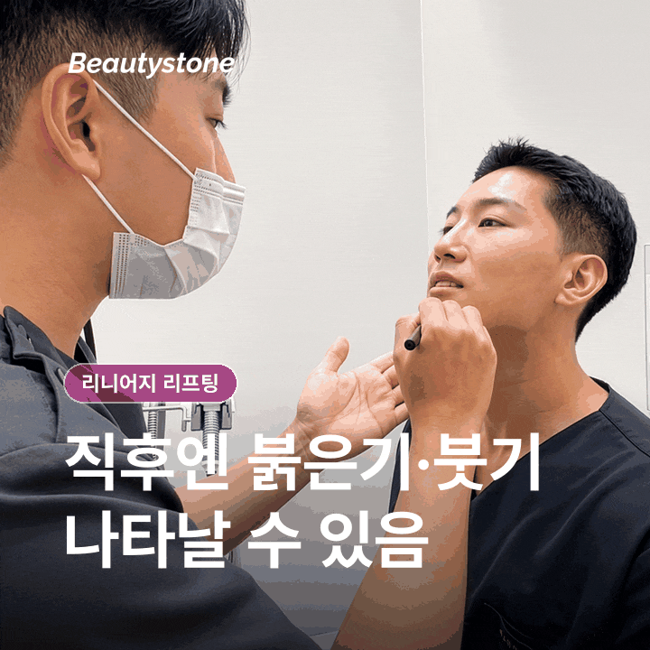 리니어지 리프팅 원리 효과부터 회복&middot;관리까지 차분히 정리 관련 이미지 6
