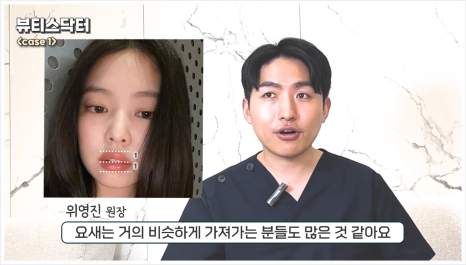 입술필러 1cc, 인중 길이 짧아보이는 이유 관련 이미지 4