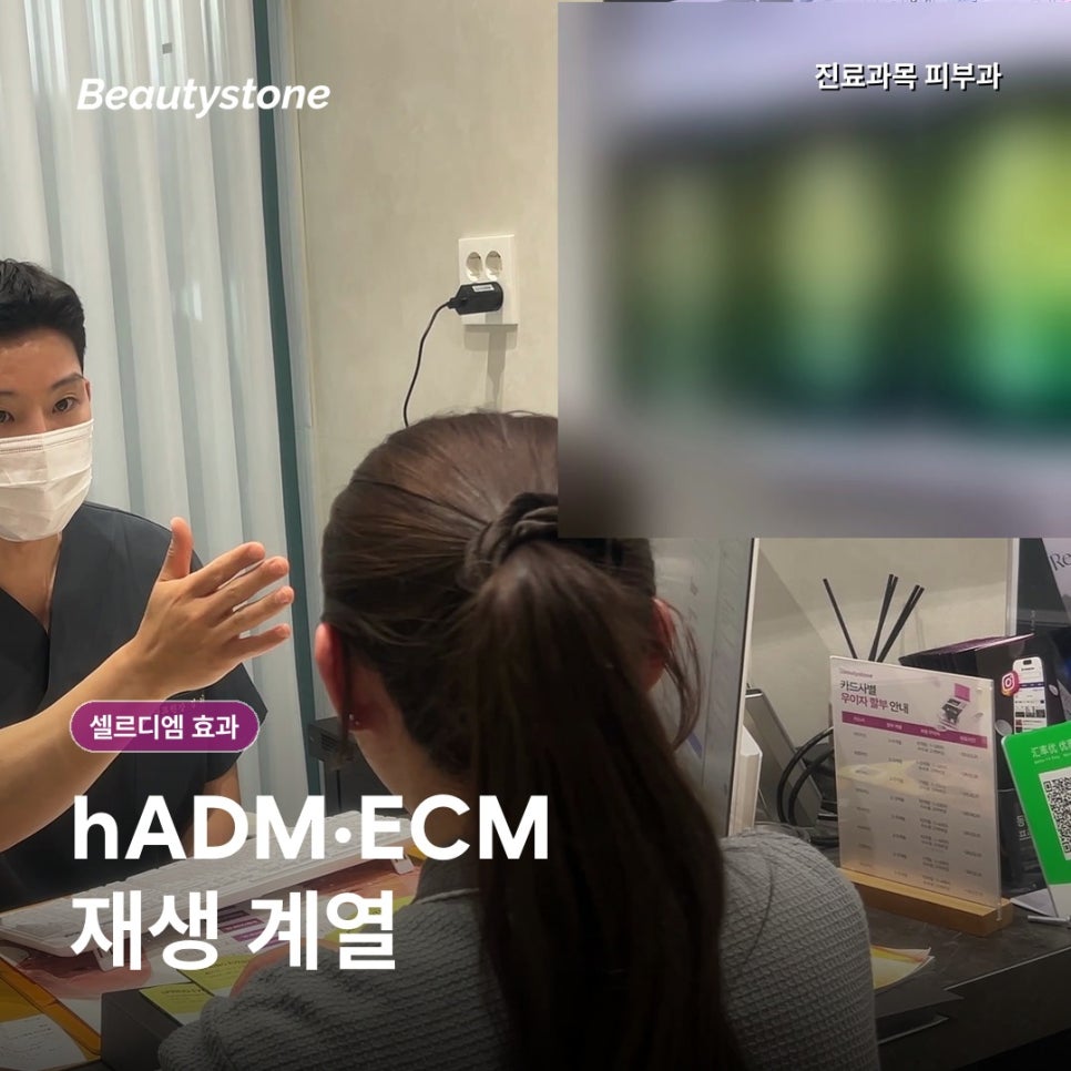 셀르디엠 효과, 언제부터 어떤 기준으로 살펴볼까? 관련 이미지 2