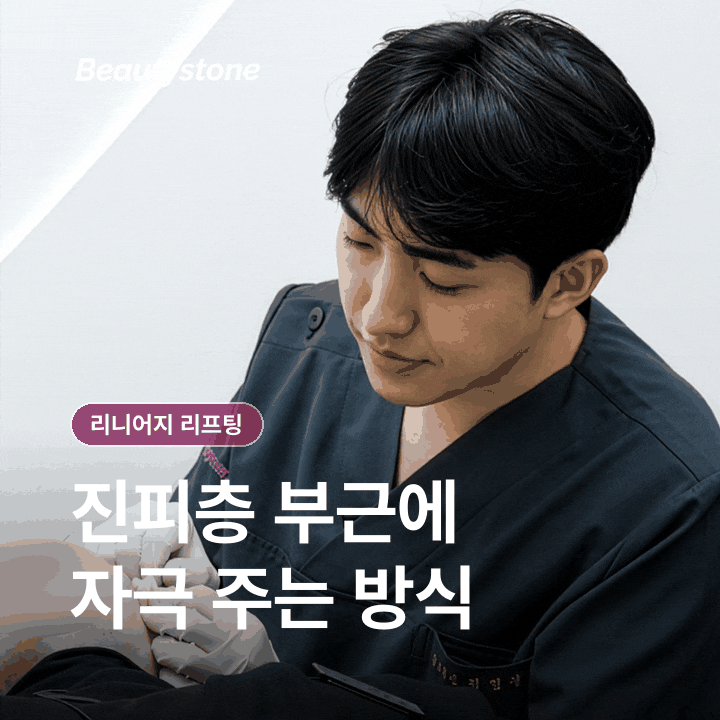 리니어지 리프팅 원리 효과부터 회복&middot;관리까지 차분히 정리 관련 이미지 3
