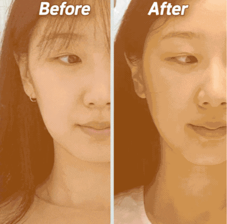 올리지오보톡스, 함께하면 좋은 이유 관련 이미지 3