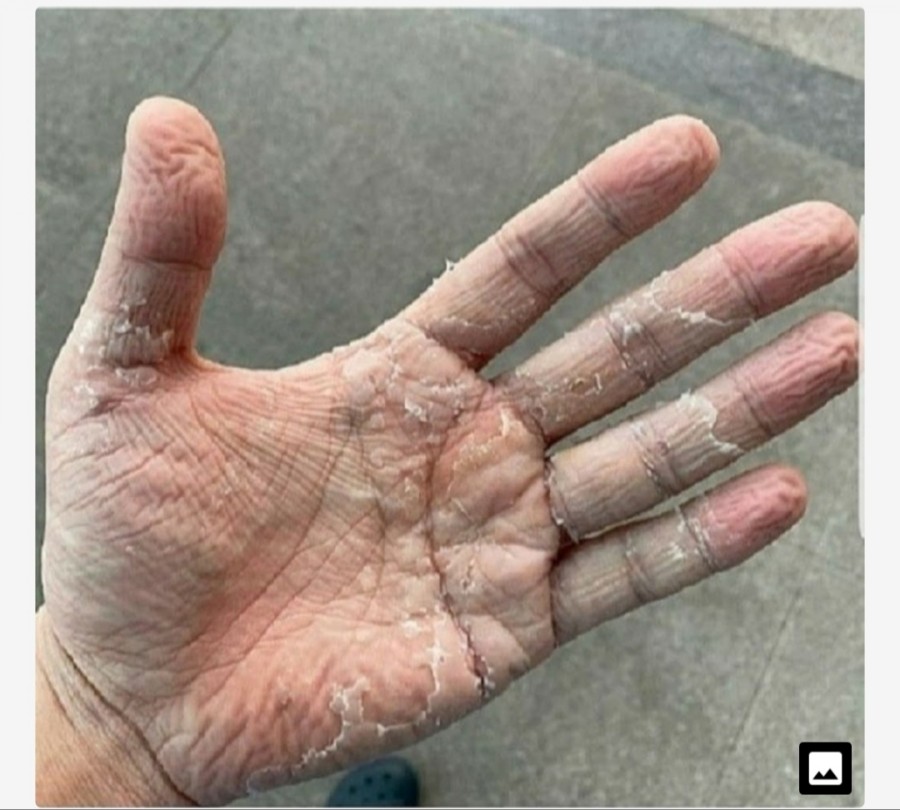 이태원 클럽 코로나 확진자, 벌써 50명.. 관련 이미지 4