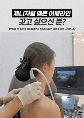 승모근 보톡스 주기와 같이 보는 후기 관련 이미지 4