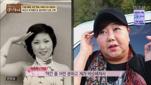 가수 이은하 쿠싱증후군, 급격한 20kg증량 쿠싱증후군 증상과 예방법 관련 이미지 4