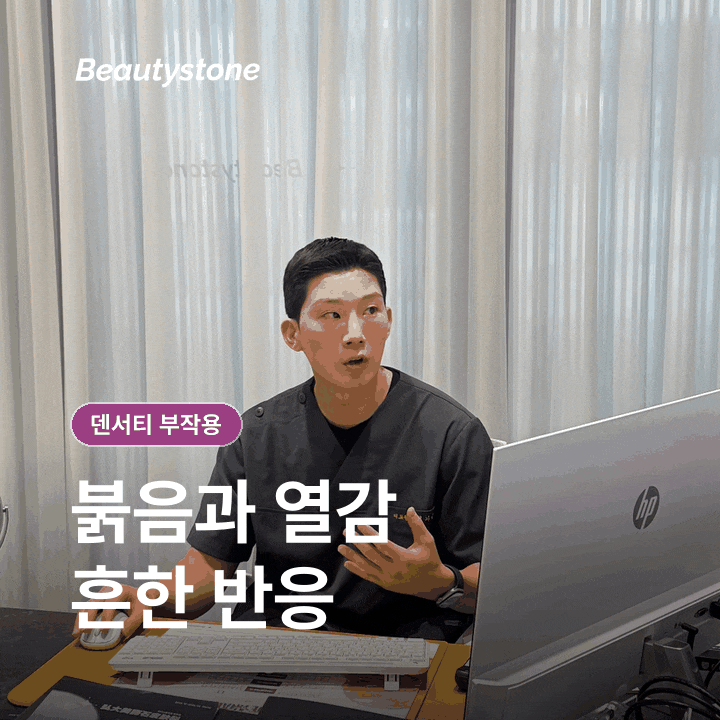 마포구청 덴서티 부작용, 화상과 볼패임은 왜 생길까요? 관련 이미지 3