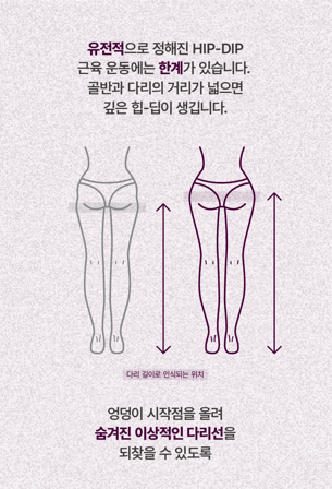 합정 스컬트라 효과 엉덩이, 힙딥에 좋은 이유 관련 이미지 3