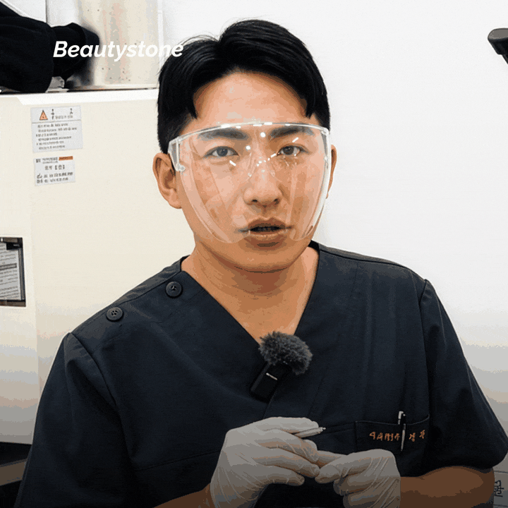Can I Have a Black Spot Removed Right Away? What to Check Before Laser Treatment image 2