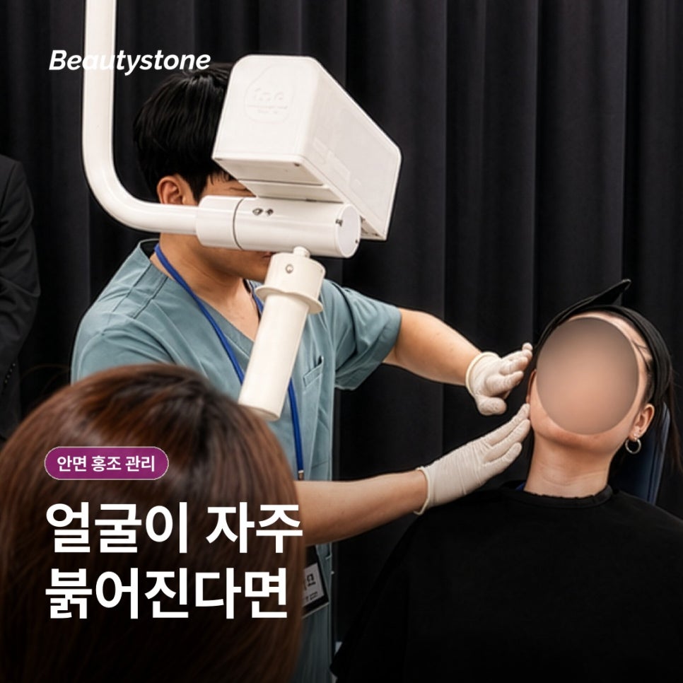 안면 홍조 관리 전 알아둘 생활 습관과 진료 기준 관련 이미지 3