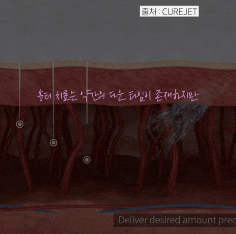 강서 피부과, 모공축소 효과적인 방법 관련 이미지 4