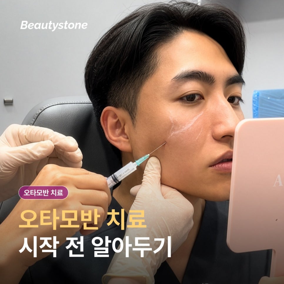 얼굴 푸른 점 오타모반 치료, 레이저 원리와 횟수&middot;시술 후 관리 관련 이미지 1
