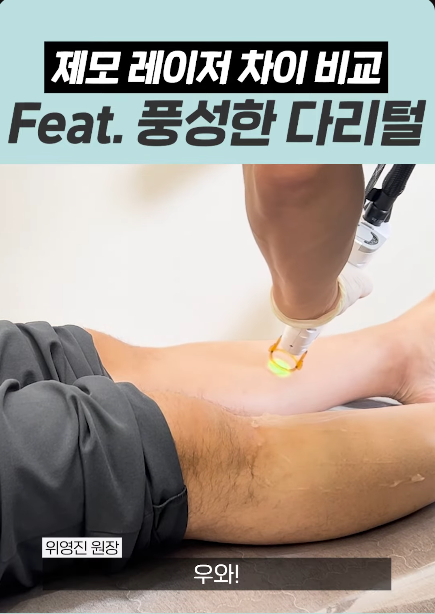 홍대입구역 피부과 남자다리털 제모, 반복 없이 줄이는 핵심 관련 이미지 3