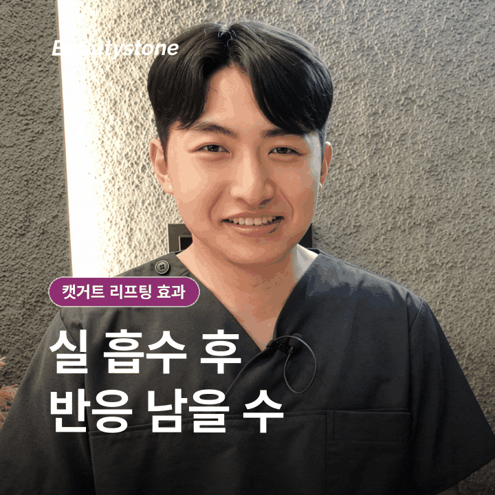신촌 캣거트 리프팅 효과, 당김과 유지 기간은 어떻게 볼까요? 관련 이미지 10