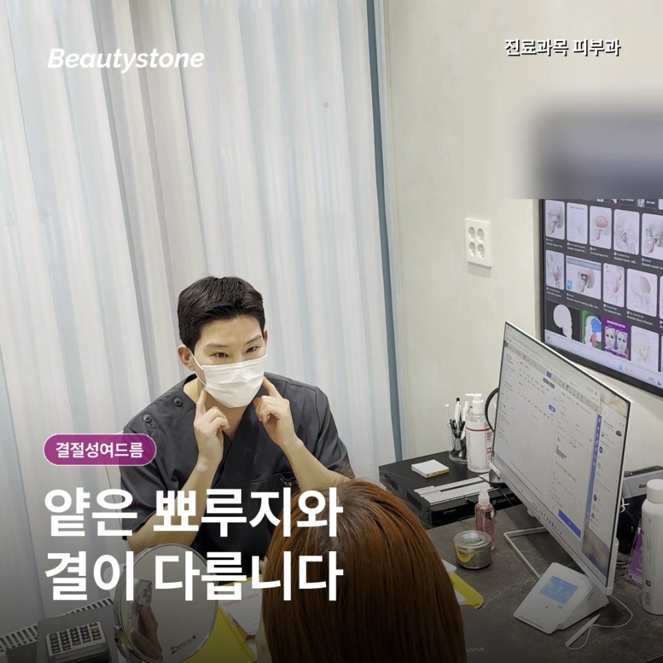 결절성 여드름, 가라앉아도 같은 자리에 반복되는 이유와 치료 관련 이미지 2