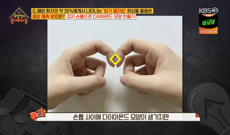 핑거클러빙, 간단한 폐암 자가진단하는 방법! 관련 이미지 3