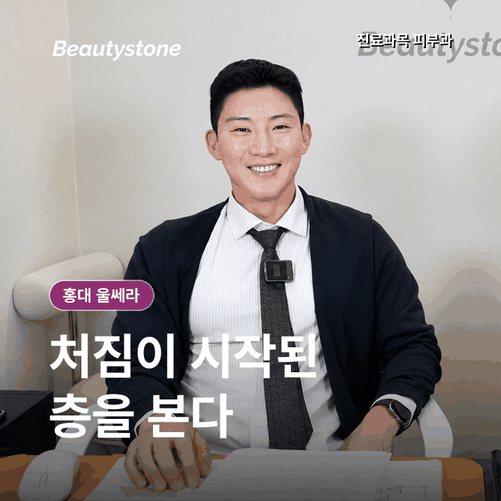 홍대 울쎄라, 300샷보다 먼저 확인할 3가지 기준 관련 이미지 3