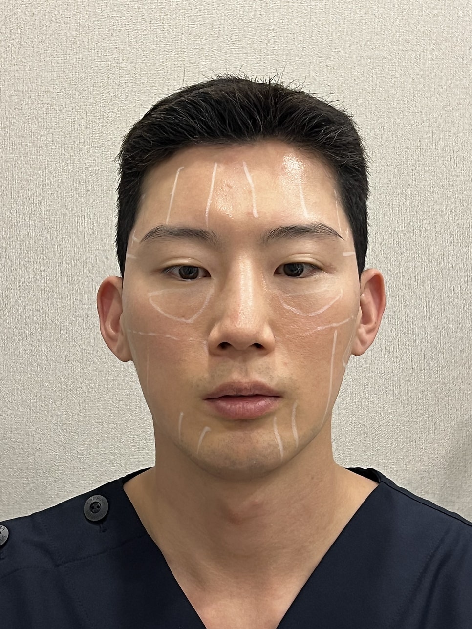 홍대 울쎄라 제대로 받는 법, 핵심만 정리했습니다 관련 이미지 4