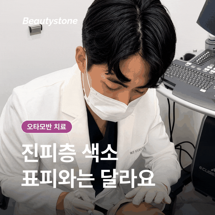 얼굴 푸른 점 오타모반 치료, 레이저 원리와 횟수&middot;시술 후 관리 관련 이미지 3