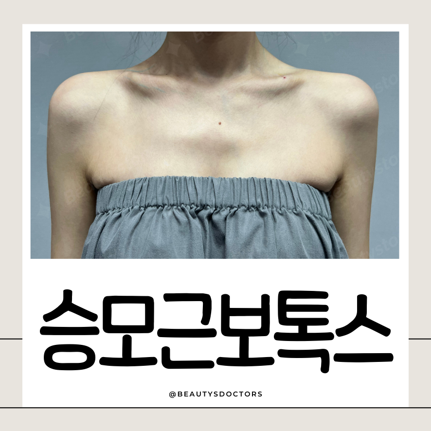 서교동 피부과 승모근 보톡스, 목이 길어 보이는 어깨라인의 비밀 관련 이미지 1