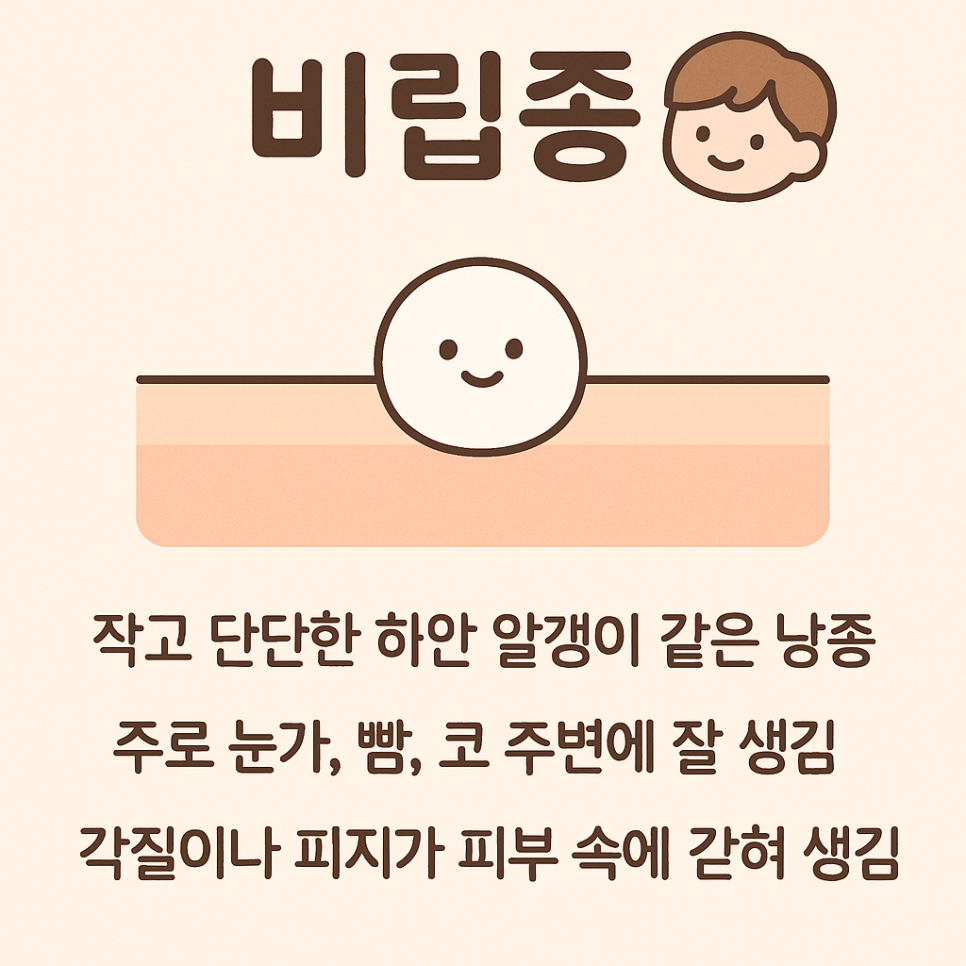비립종 피부과에서 해결하는 법 관련 이미지 2