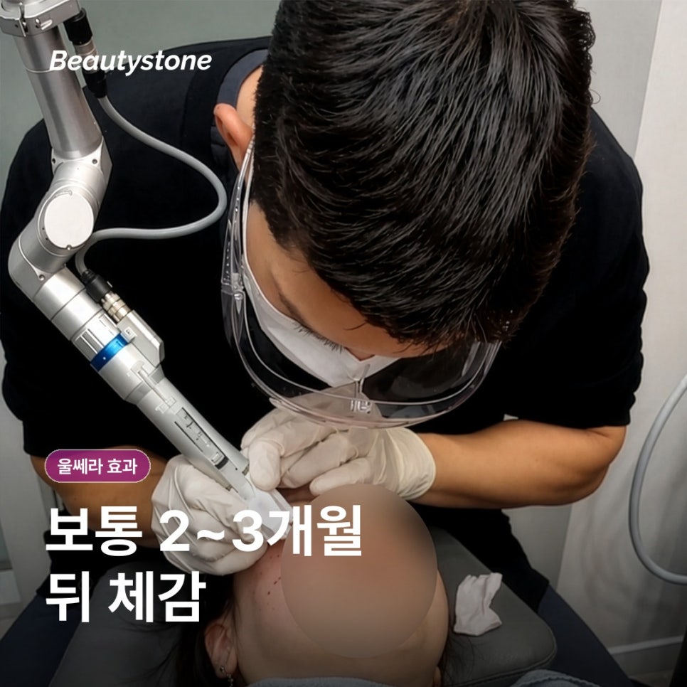 울쎄라 효과, 언제 어떻게 나타날까 관련 이미지 6