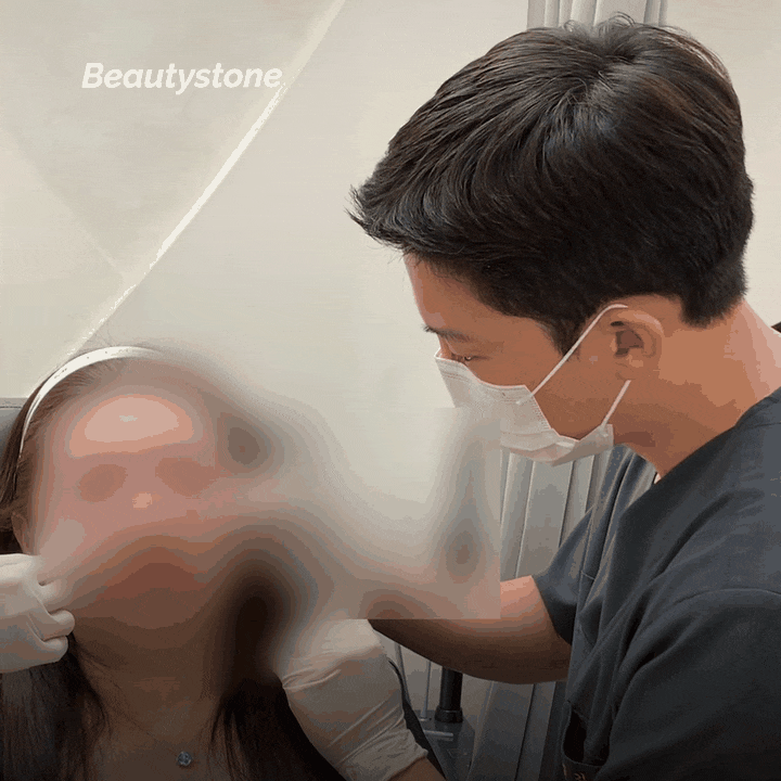 여의도역 슈링크 유니버스 주의사항, 시술 전후 무엇을 확인해야 할까요? 관련 이미지 15