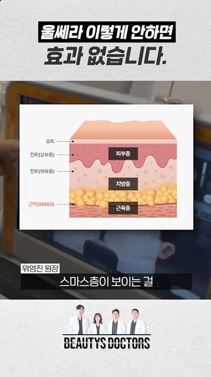 홍대 울쎄라 제대로 받는 법, 핵심만 정리했습니다 관련 이미지 2