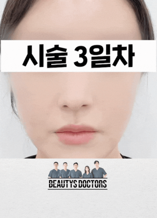 마포구 피부과, 스킨바이브,쥬베룩,리쥬란,리바이브 정리 관련 이미지 2