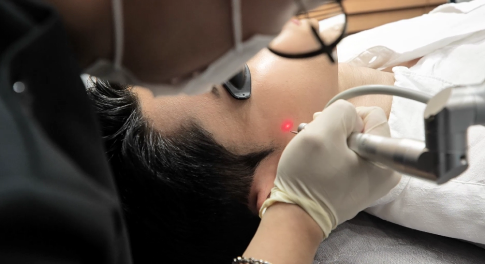 Melasma and Dark Spots Laser: Why Does It Keep Getting Darker? Causes Revealed image 10