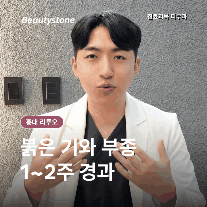 홍대 리투오, 20대·30대, 나이보다 먼저 확인할 피부 상태 관련 이미지 7