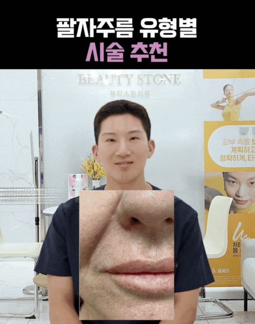 팔자주름없애기 시술, 필러만으로 부족한 이유 관련 이미지 3