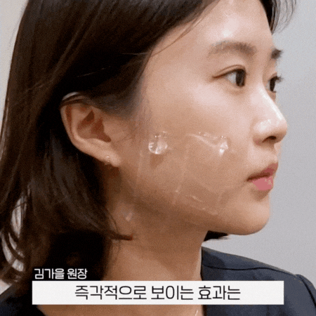 울쎄라 슈링크 효과 없음이라는 후기, 진짜 이유 관련 이미지 3