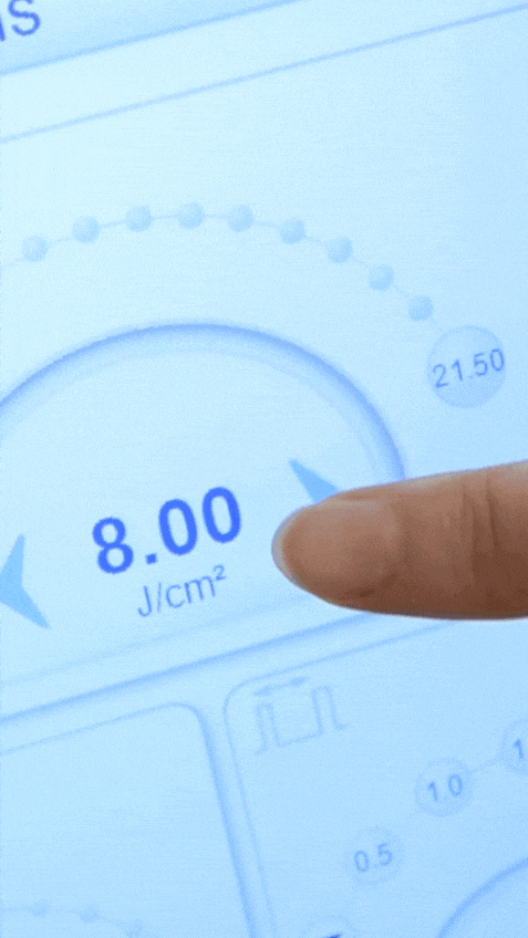 레이저 제모 효과는 어떻게 누적될까? 겨울 제모 설계의 핵심 관련 이미지 2