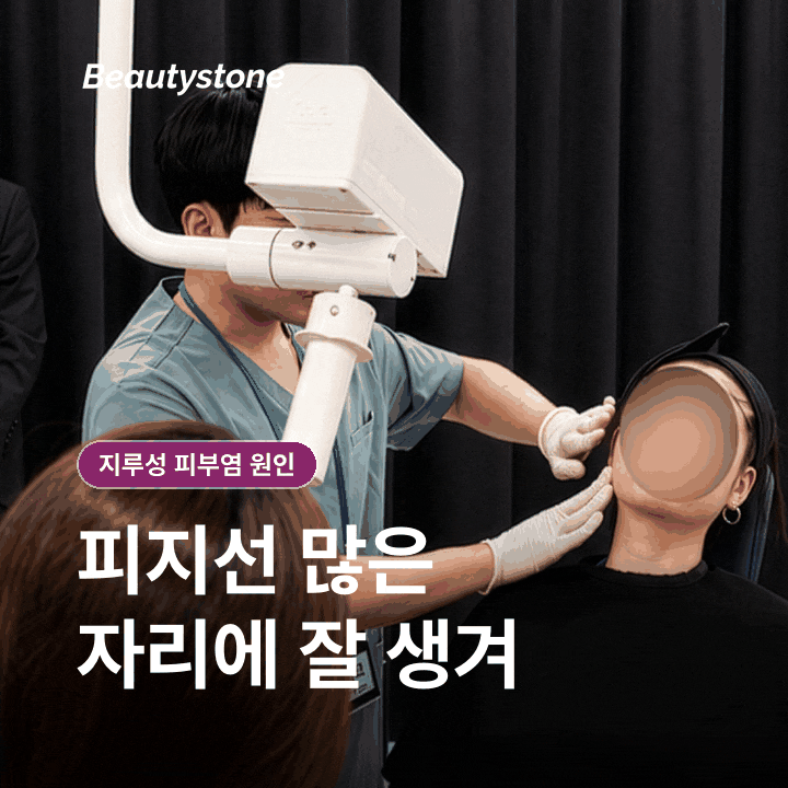 지루성 피부염 원인은 무엇일까? 반복되는 각질과 붉음의 배경 관련 이미지 1