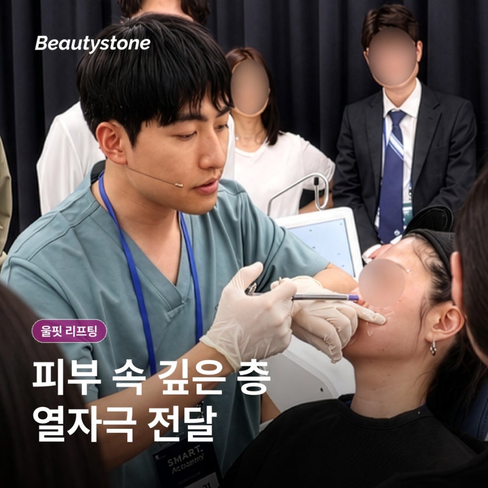 울핏 리프팅, 초음파 원리와 회복 관리 담담히 정리 관련 이미지 2