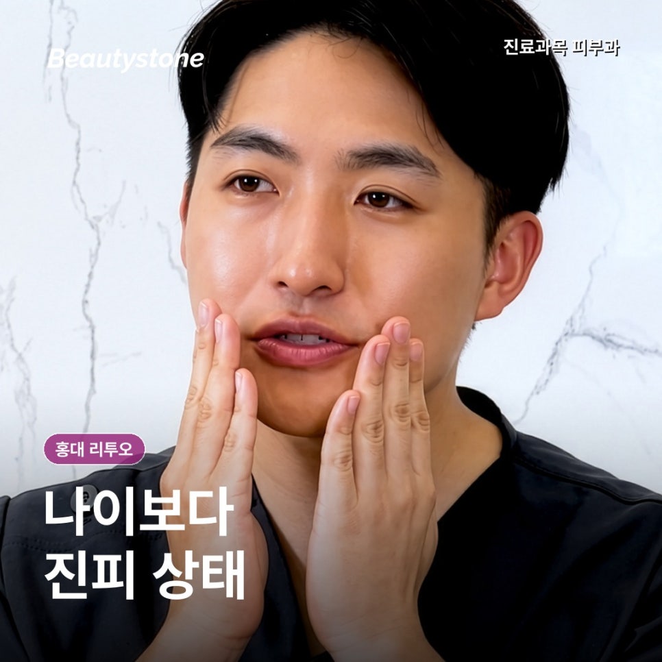 홍대 리투오, 20대·30대, 나이보다 먼저 확인할 피부 상태 관련 이미지 2