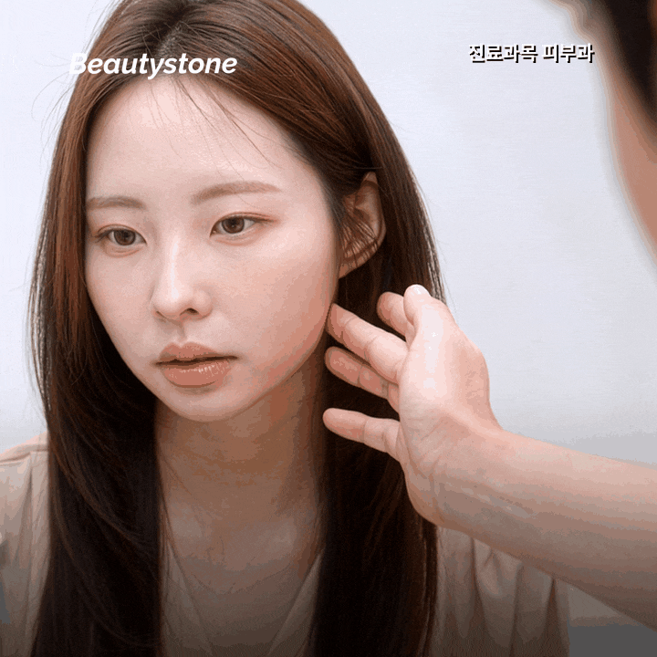 홍대 울쎄라, 300샷·400샷수보다 중요한 마킹 기준 관련 이미지 8