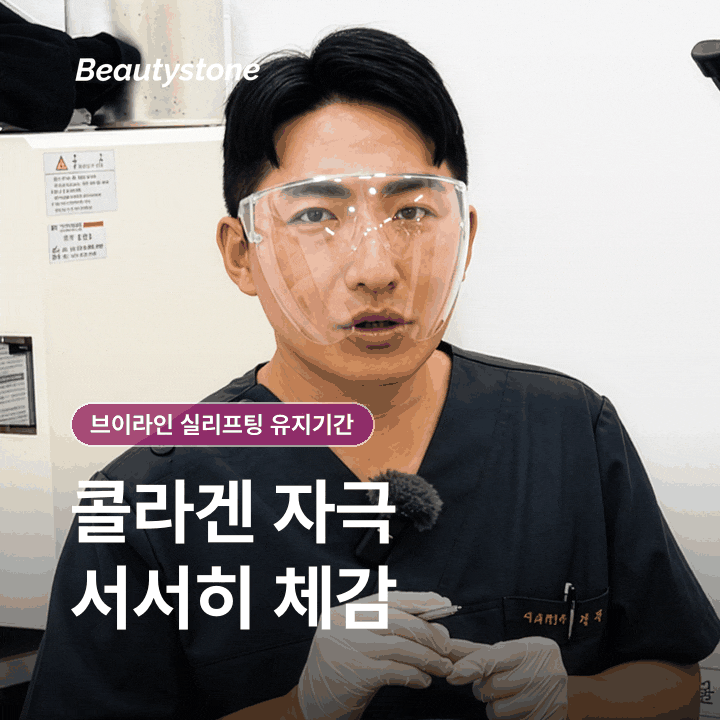 브이라인 실리프팅 유지기간, 얼마나 오래 갈까 관련 이미지 4