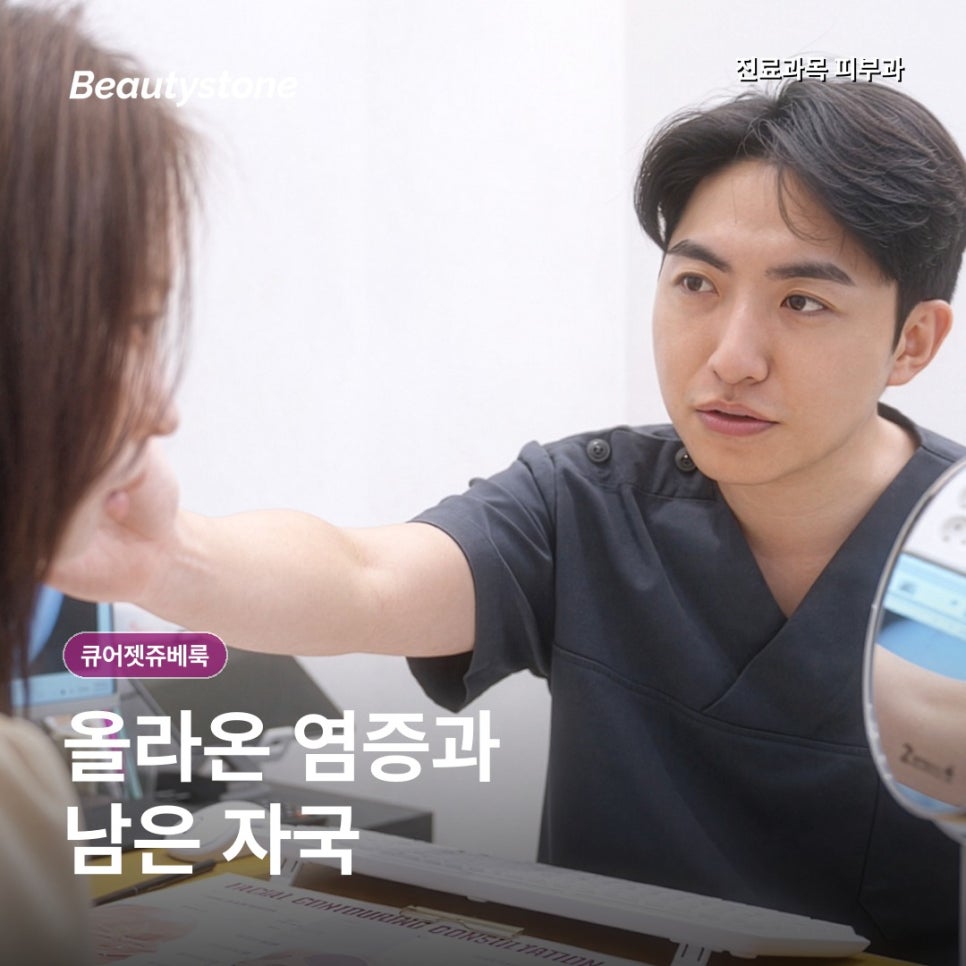 큐어젯쥬베룩, 턱선 여드름자국은 같은 흉터가 아닙니다 관련 이미지 6