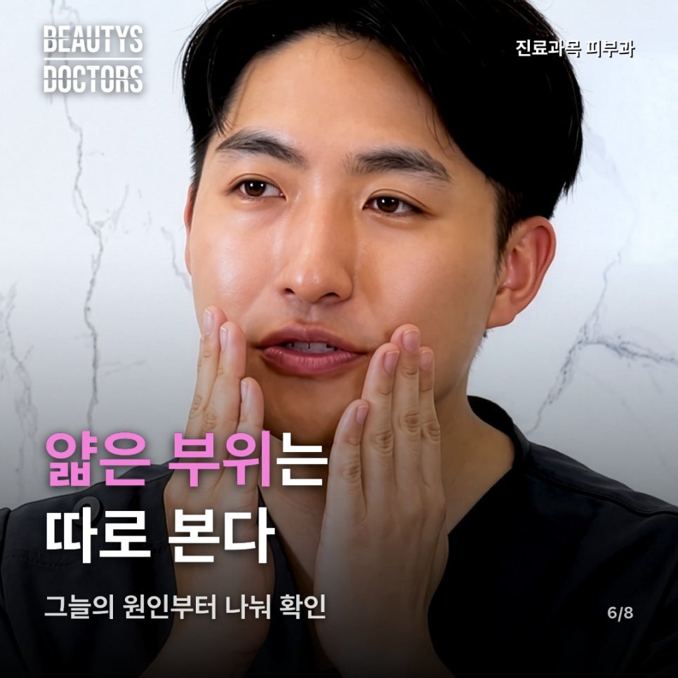 리투오 주기, 레이저 일정과 겹치면 어느 쪽을 옮길까? 관련 이미지 4