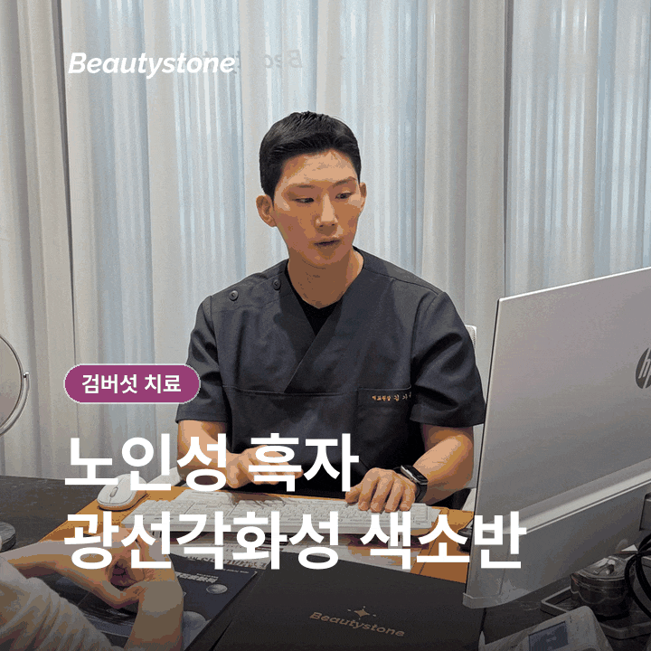 검버섯 치료, 레이저 전 구분해야 할 병변과 재발 관리 관련 이미지 2