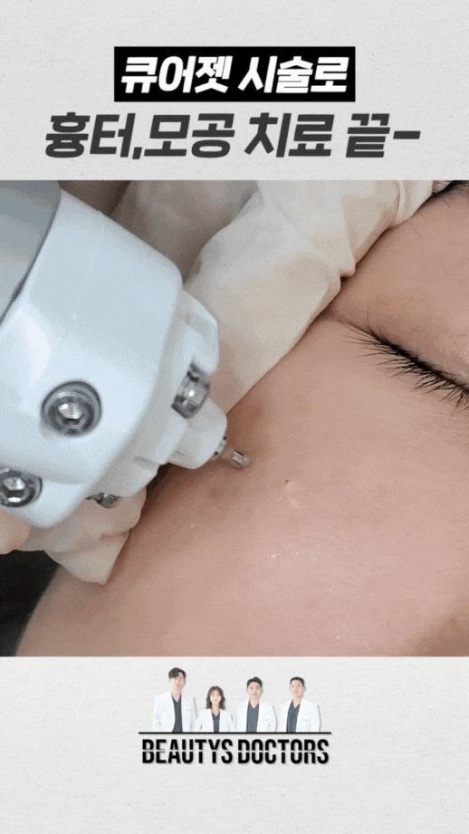상암 피부과 큐어젯 쥬베룩으로 여드름 흉터개선 가능할까? 관련 이미지 4