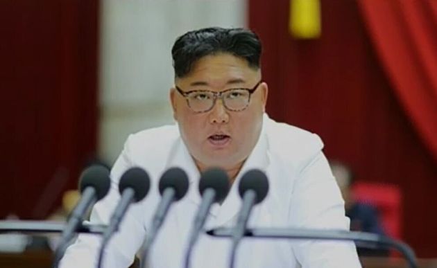 김정은 식물인간? 관련 이미지 4