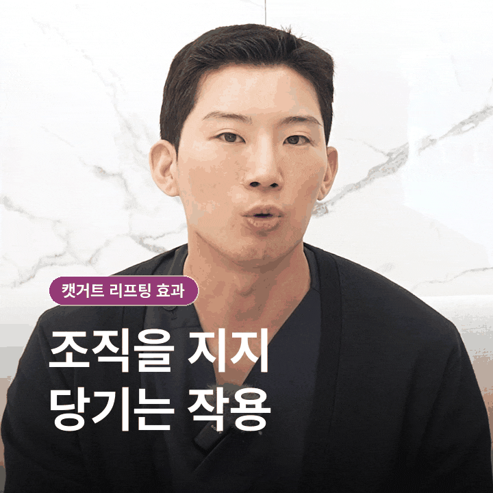 신촌 캣거트 리프팅 효과, 당김과 유지 기간은 어떻게 볼까요? 관련 이미지 4